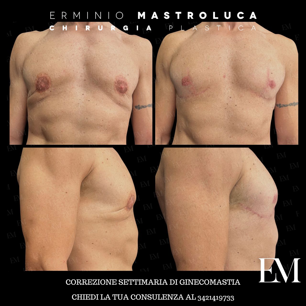 Erminio Mastroluca-16