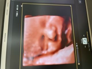 Domenico D'assisi-23