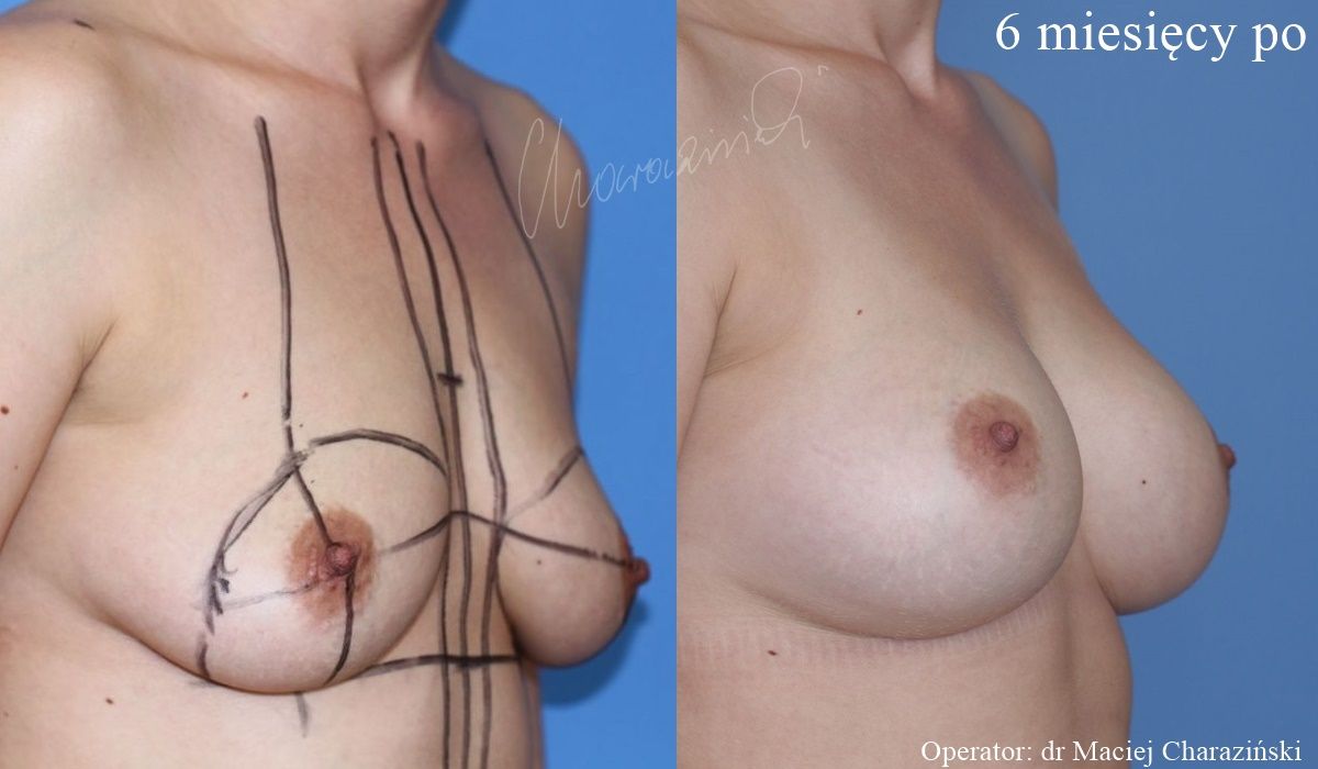 Maciej Charaziński-116