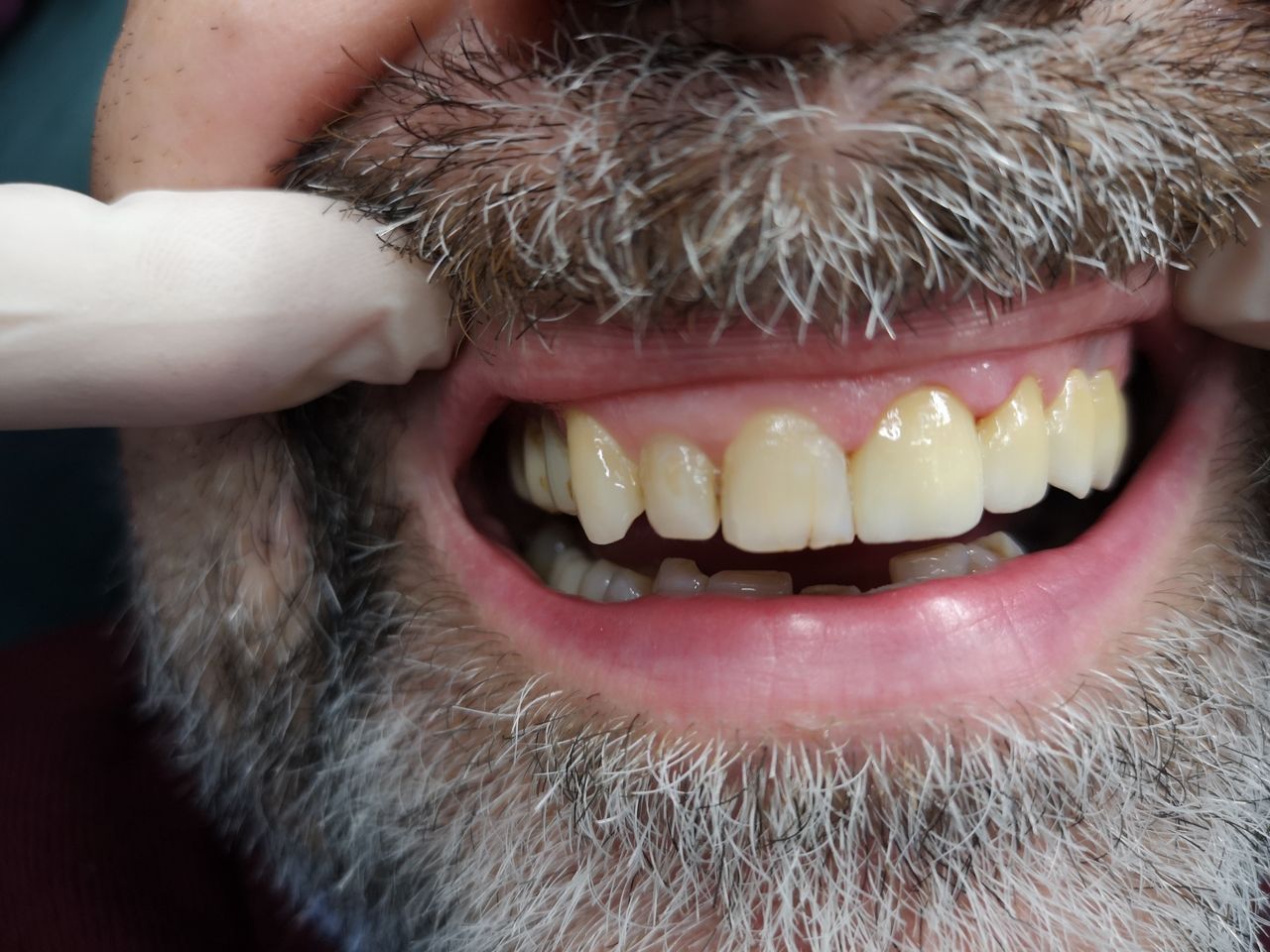 Stefano De Simone-65