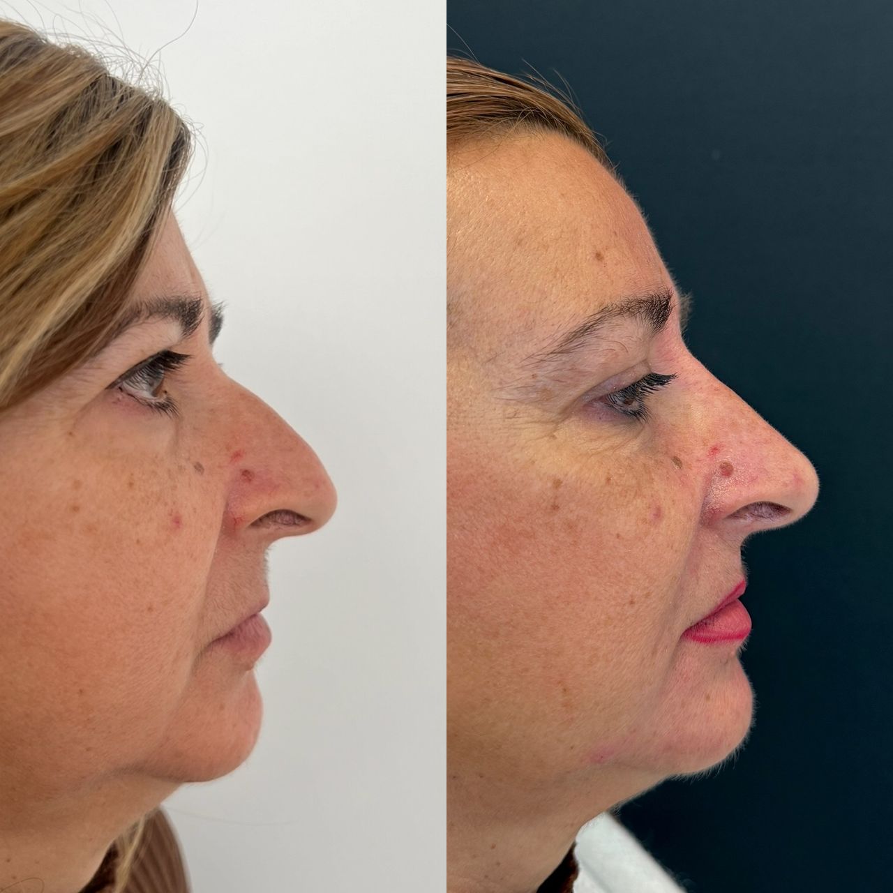 Raffaele Del Prete-10