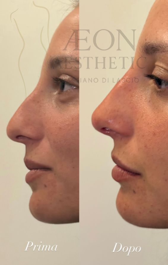 Sebastiano Di Lascio-8