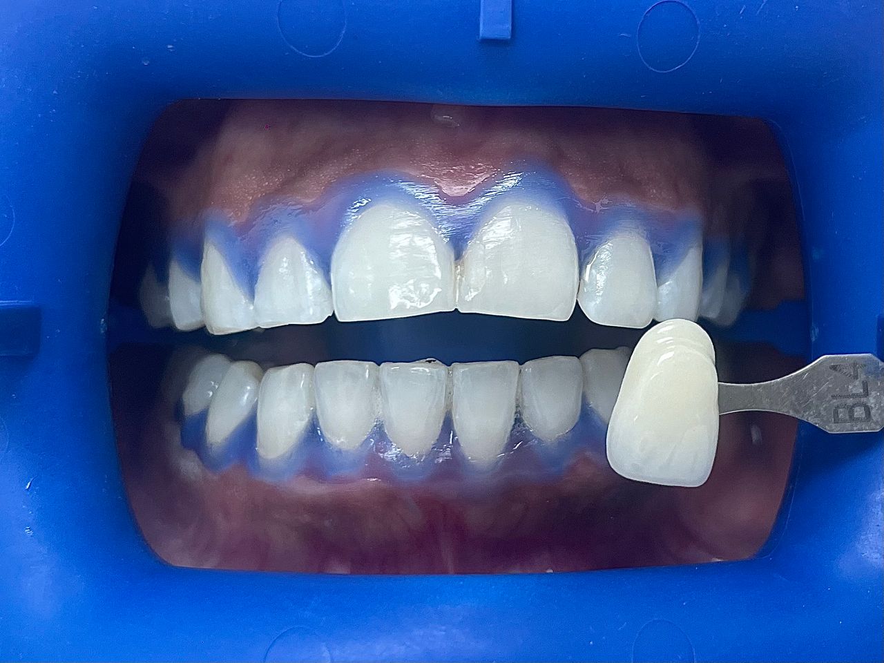 César Buján Riveiro-13