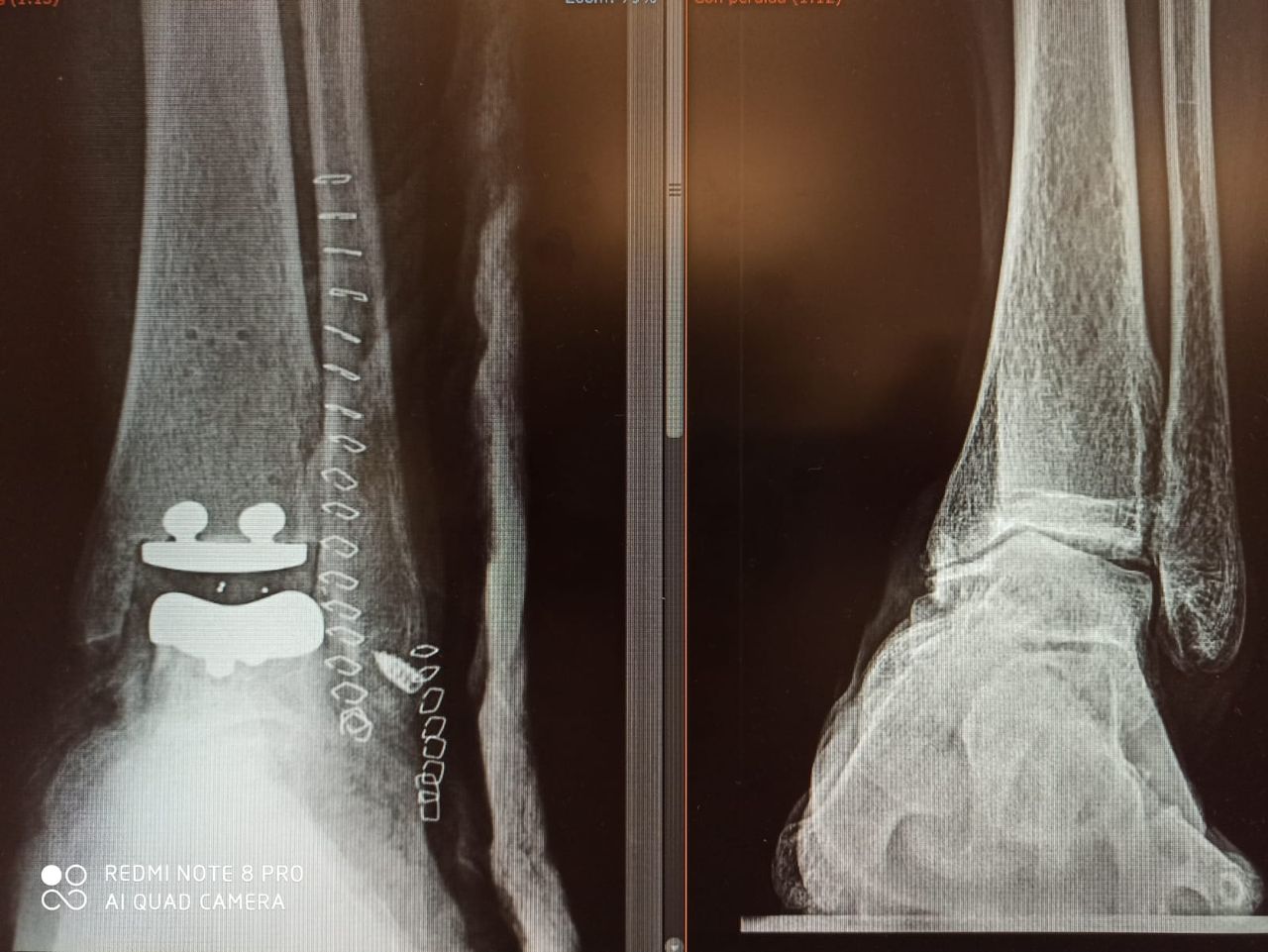 Riccardo Chiavegatti-4