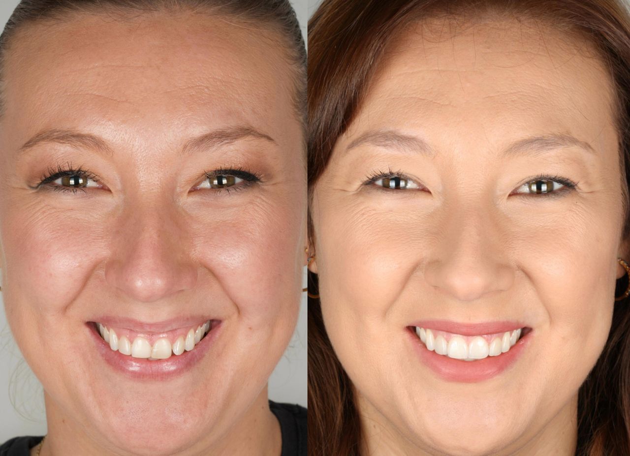 Antonia Aviles Lopez-10