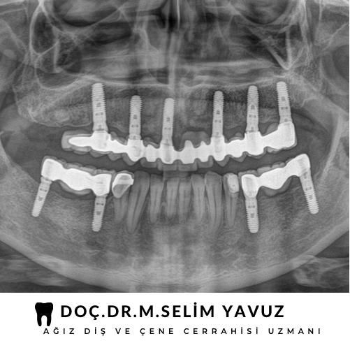 Muhammed Selim Yavuz-12