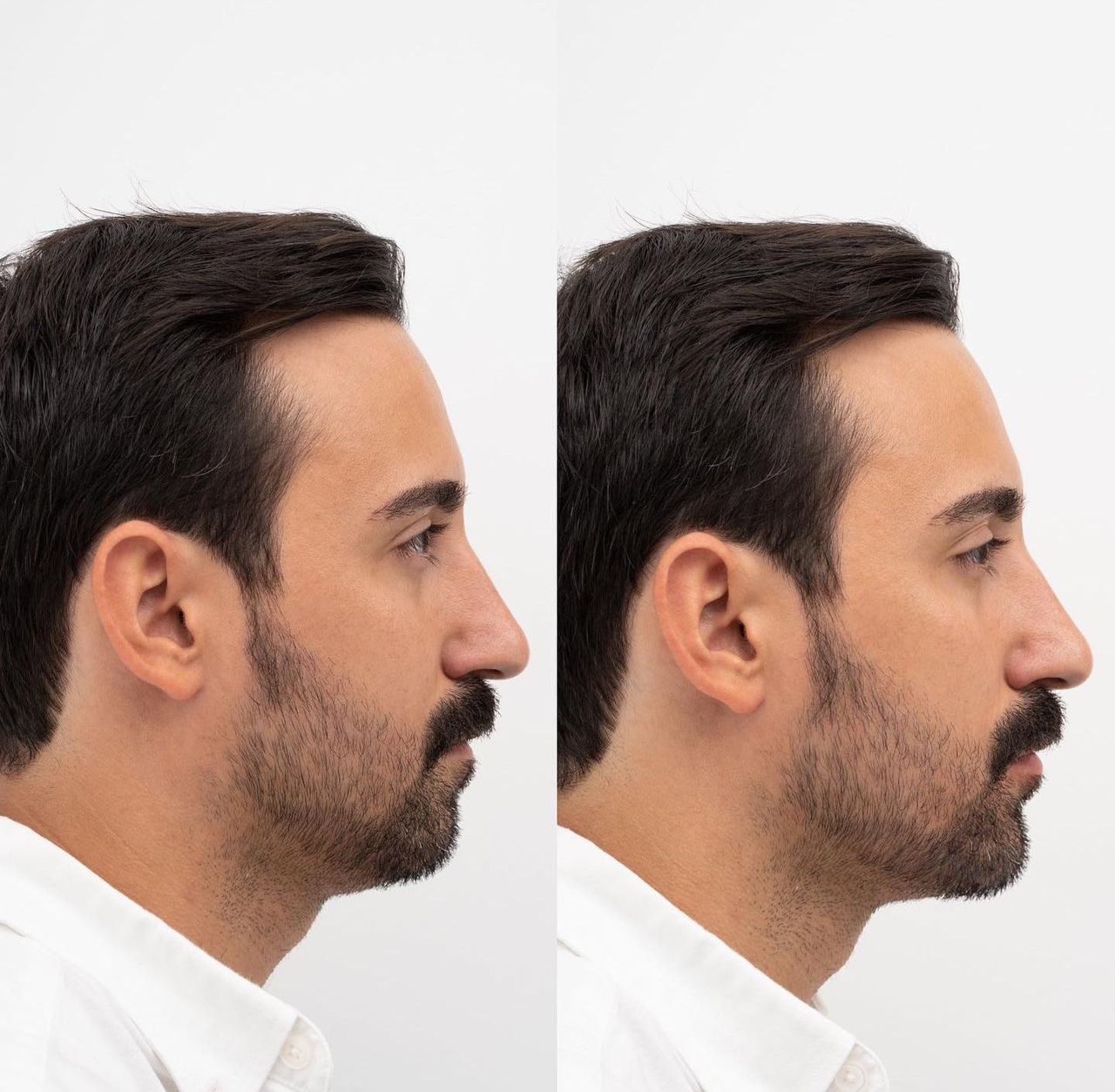 Raquel Moreno Pentinel-64