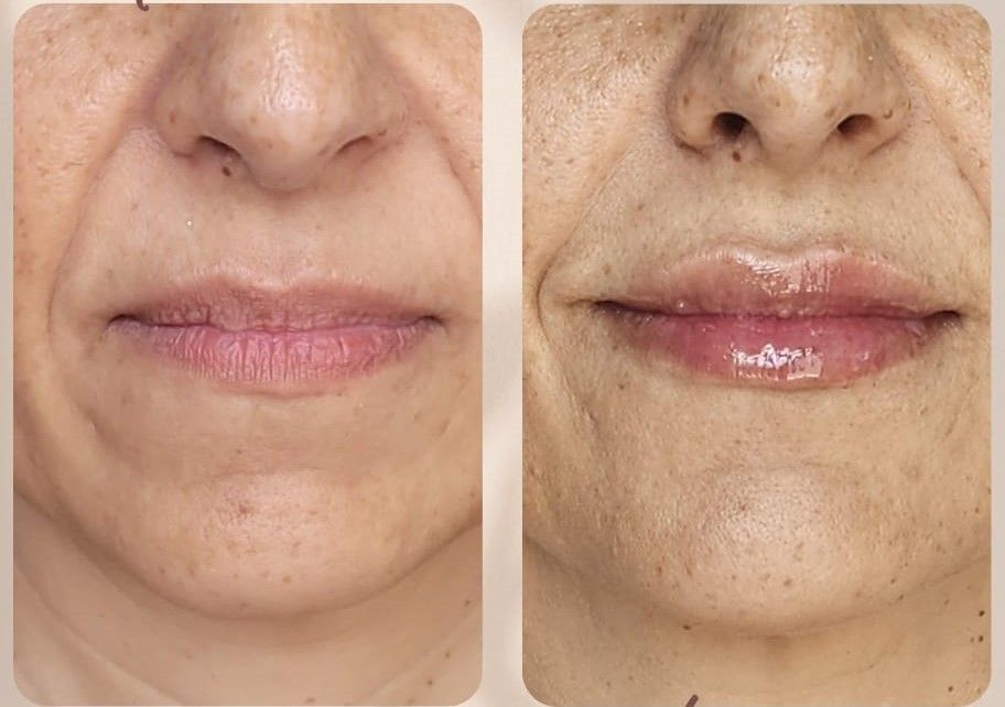 Araceli Reyes Torres-8