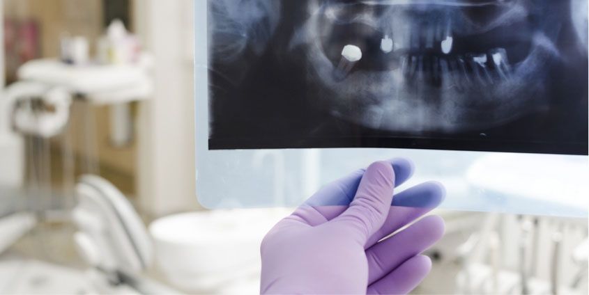 Carmen Gaebler-Wolfrum-3