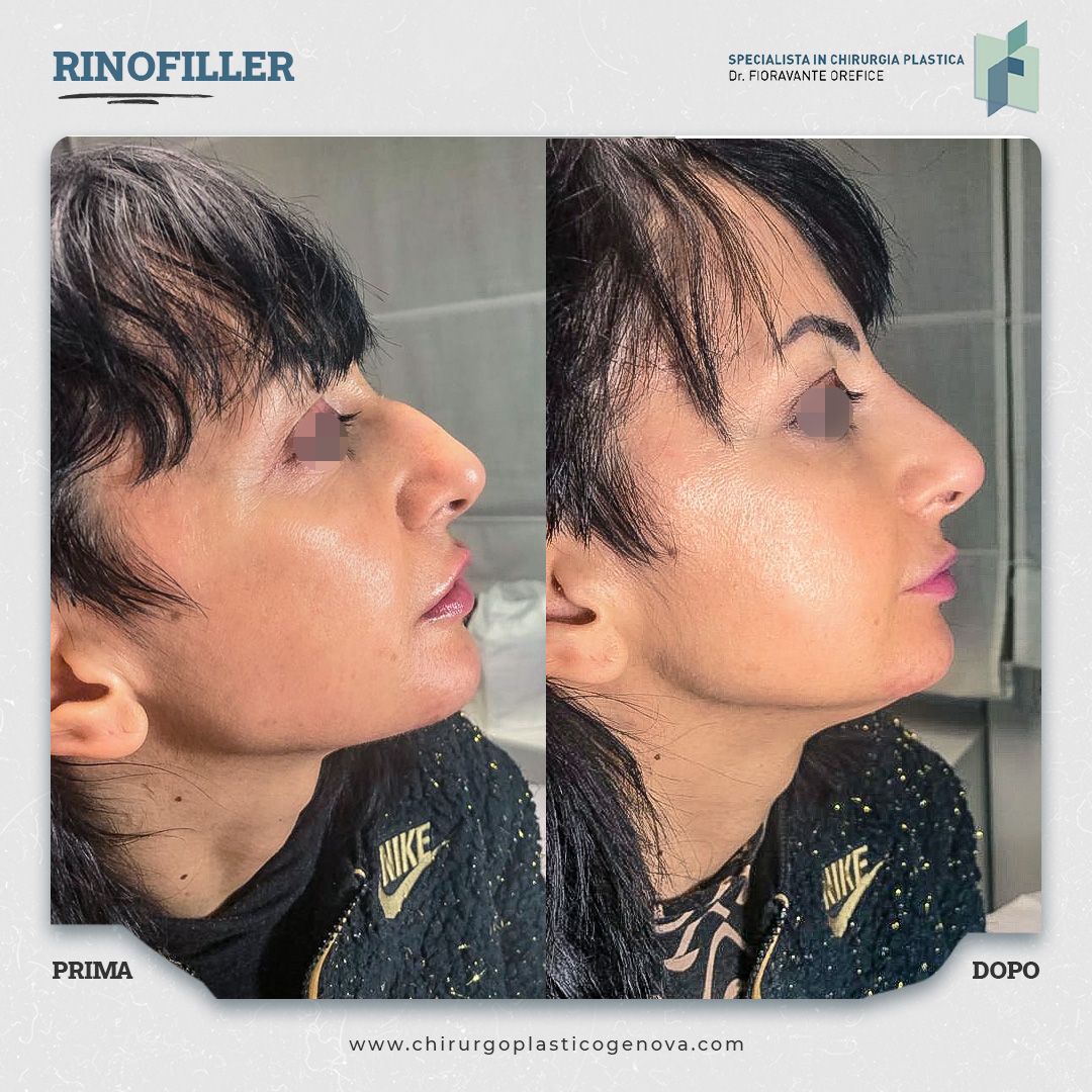 Fioravante Orefice-20