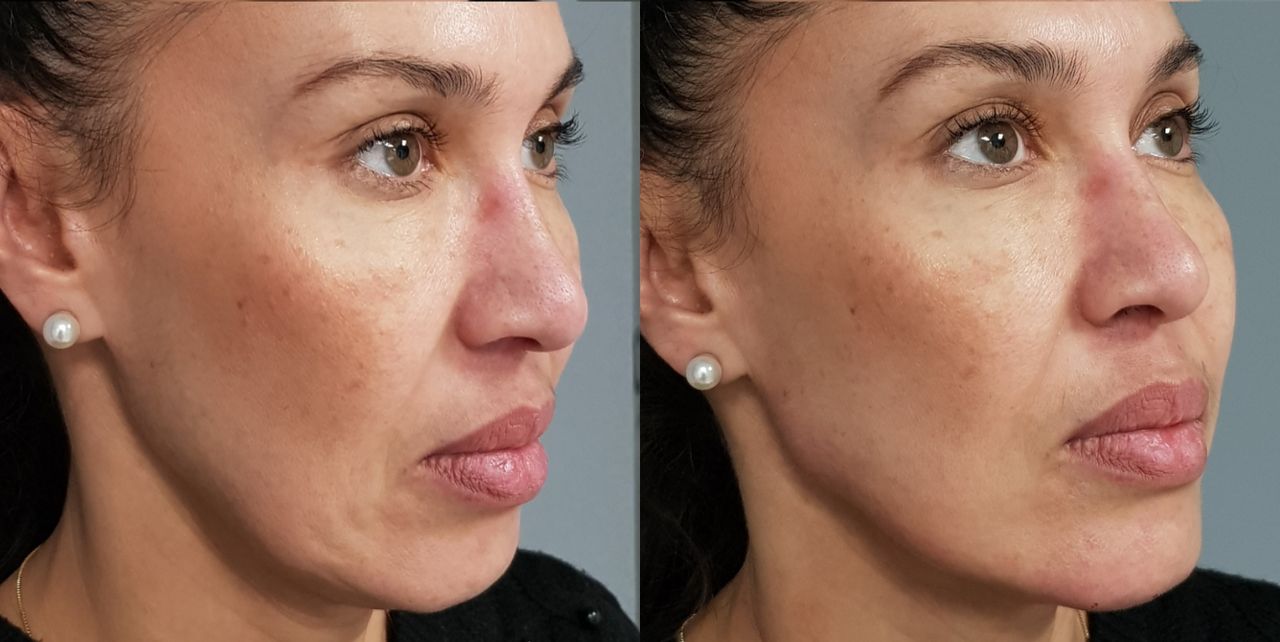 Rosalba Herrero Zerpa-67