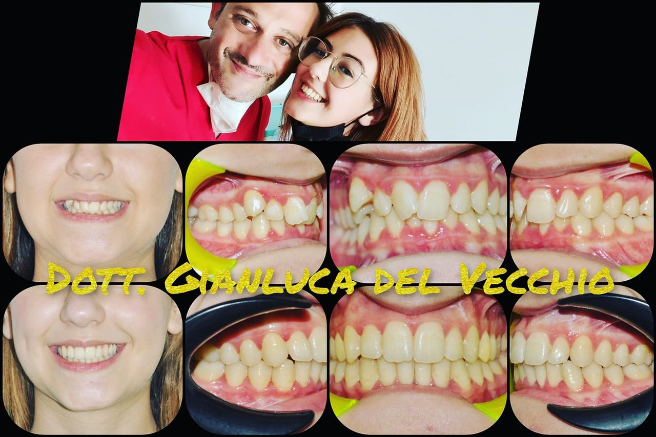 Gianluca Del Vecchio-139