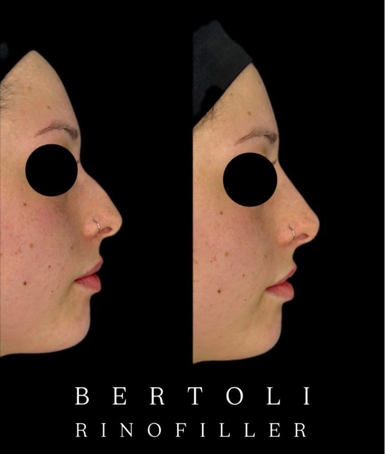Andrea Bertoli-31