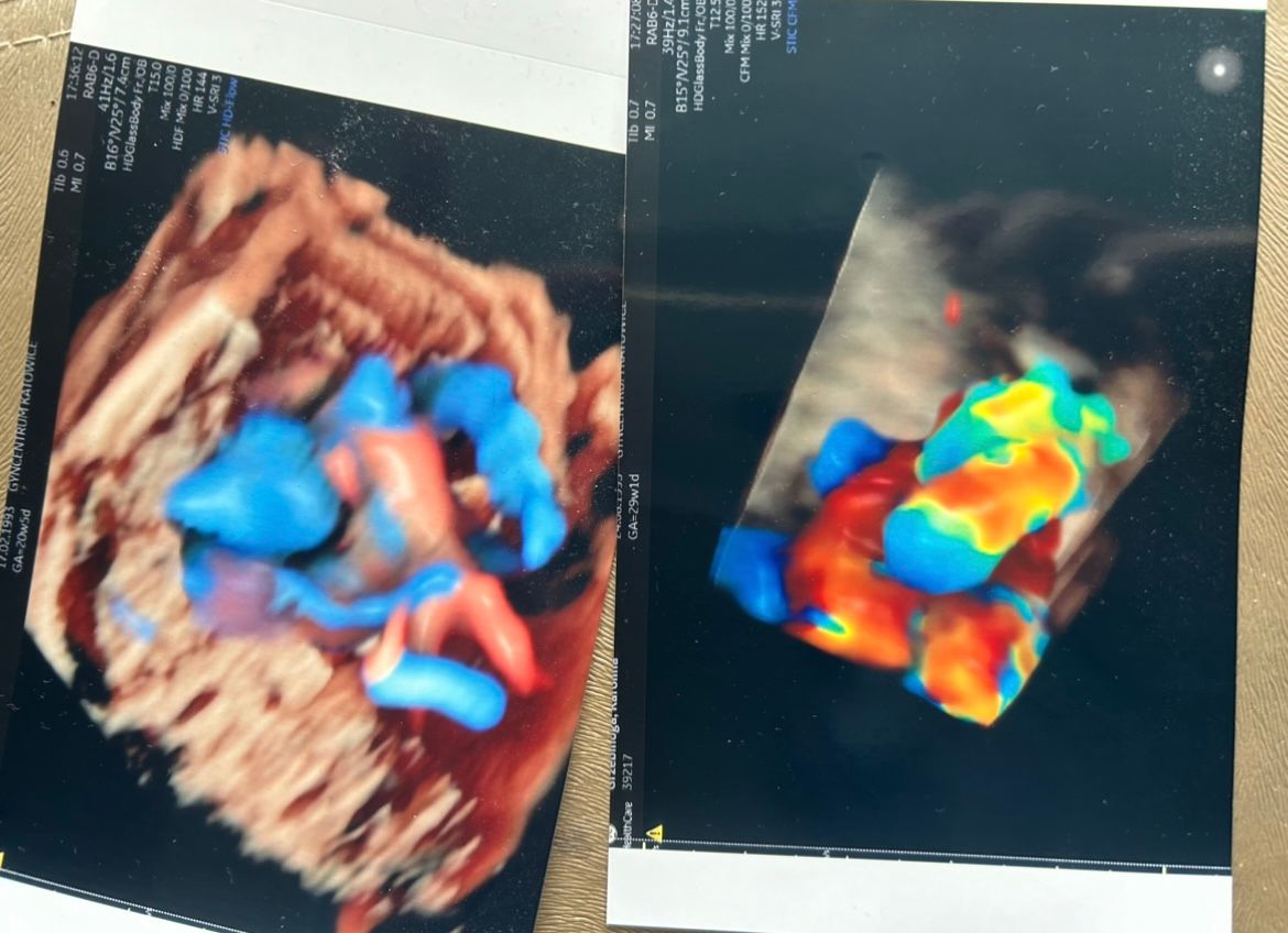 Wioletta Rozmus-Warcholińska-144