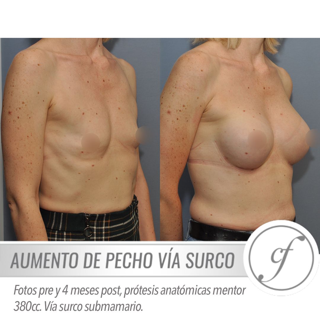 Eduardo Forcada Melero-14