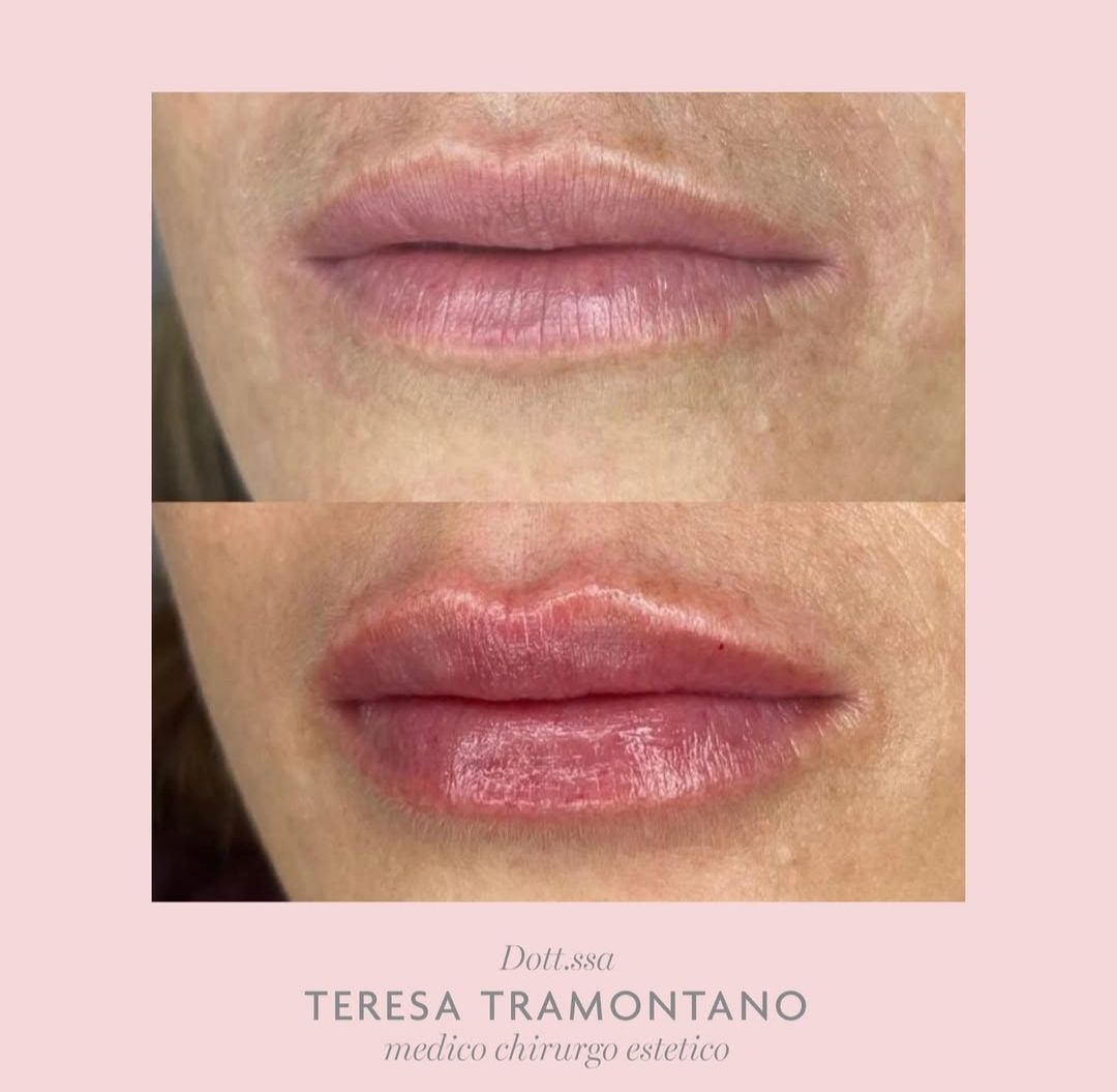 Teresa Tramontano-6