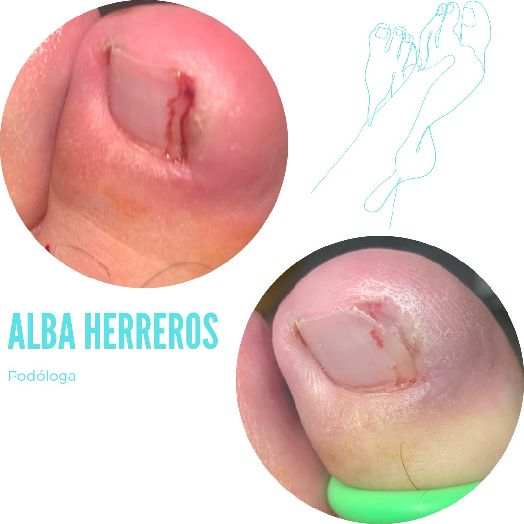 Alba Herreros Gómez-10