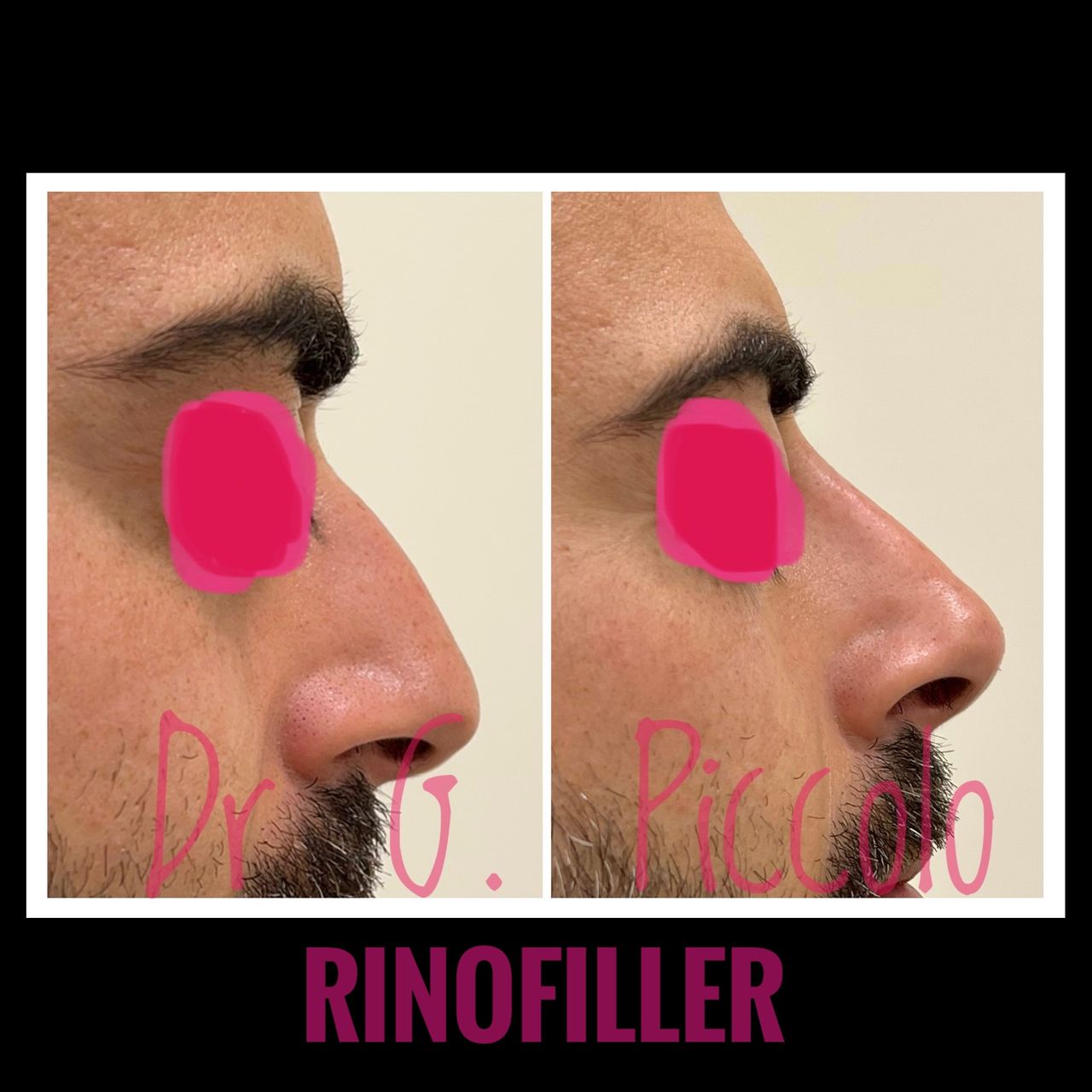 Giuseppina Piccolo-39