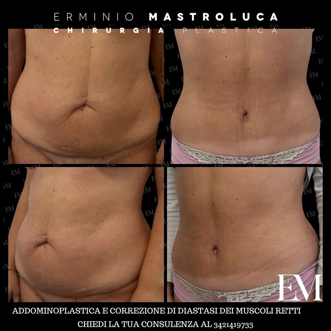 Erminio Mastroluca-11