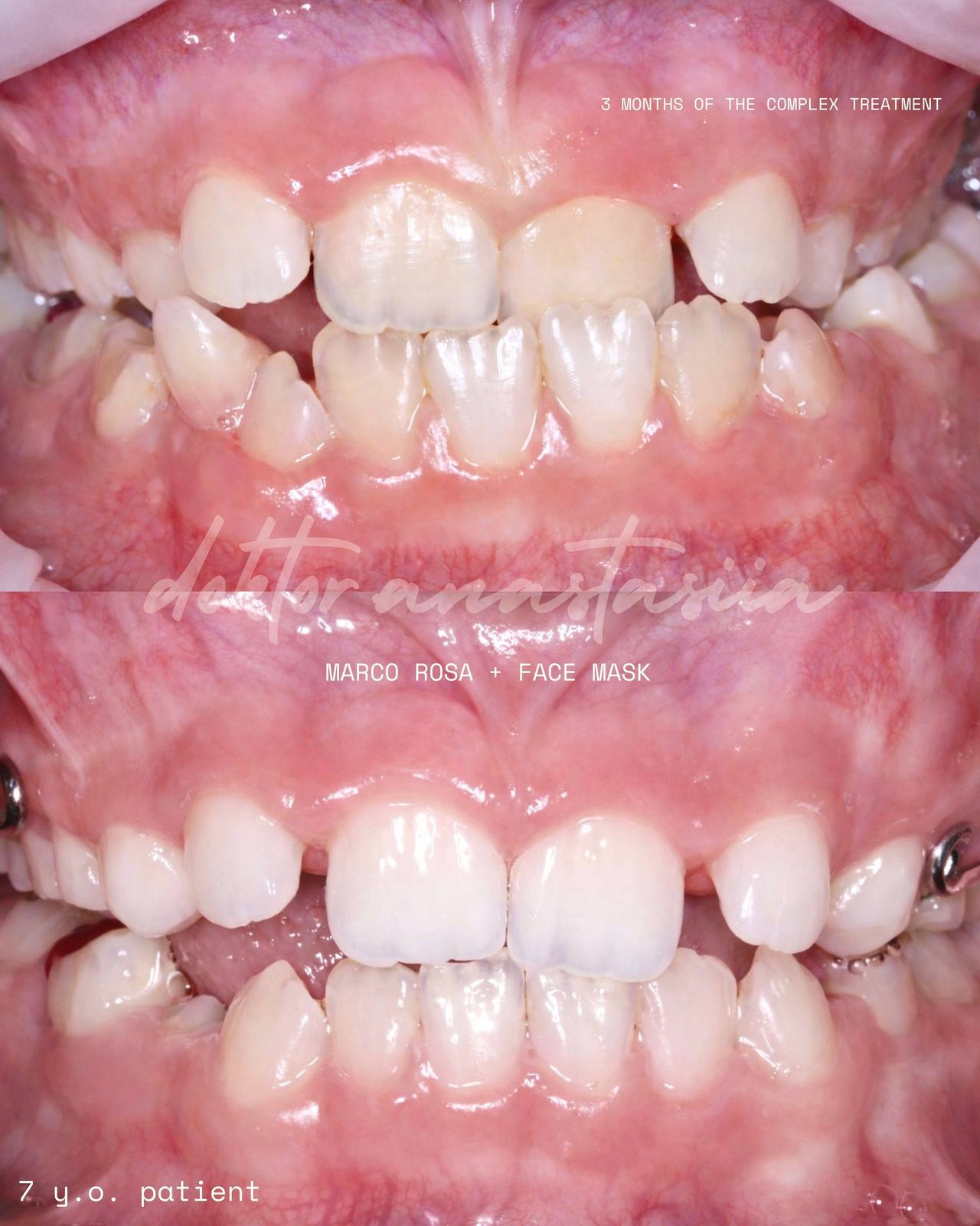 Anastasiia Malkina-1