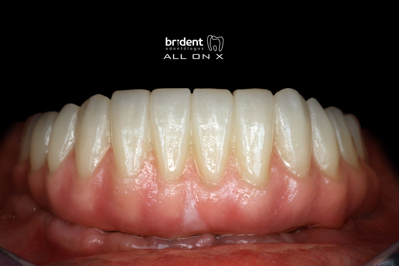 Guillermo Moreno Fragoso-39