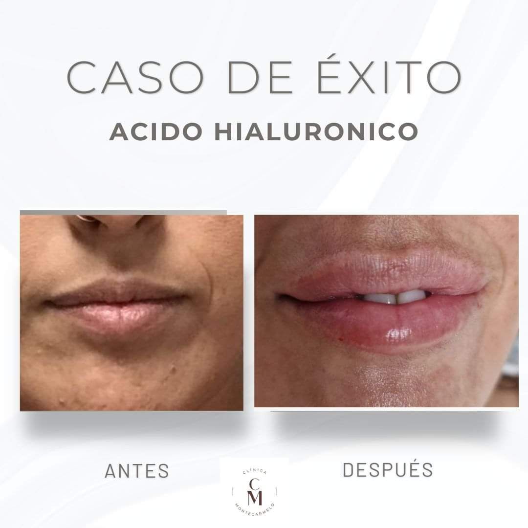 Carmen Martin Marcos-2