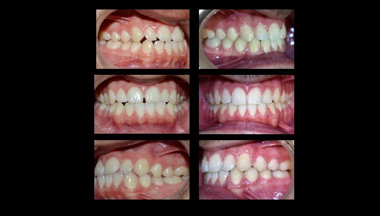 Silvia Lecuna Fourcade-3