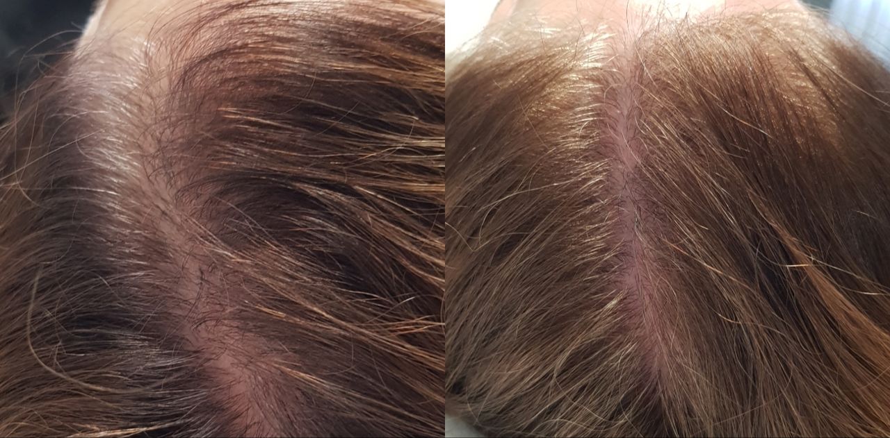 Rosalba Herrero Zerpa-214