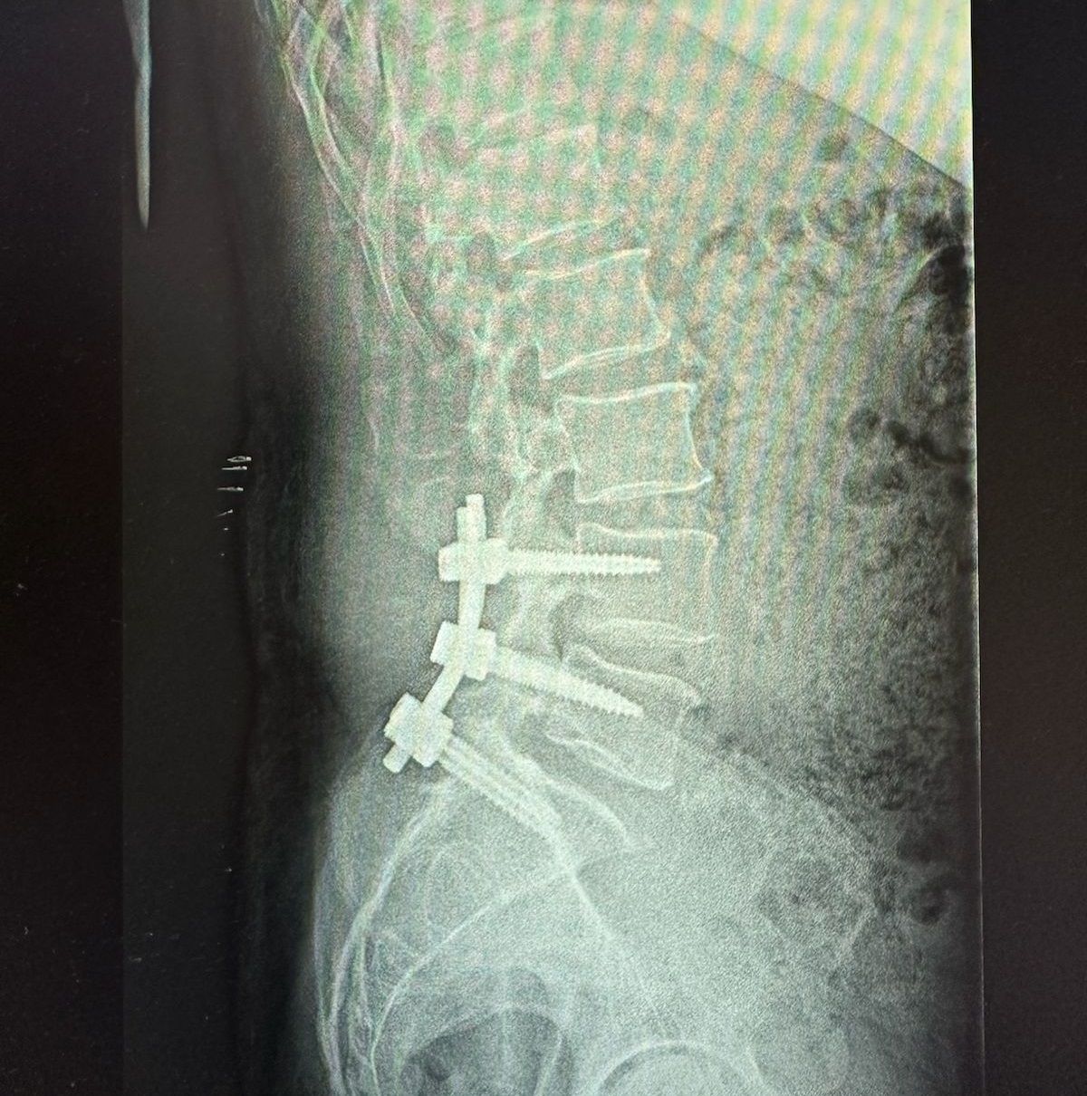 Valerio Cipolloni-26