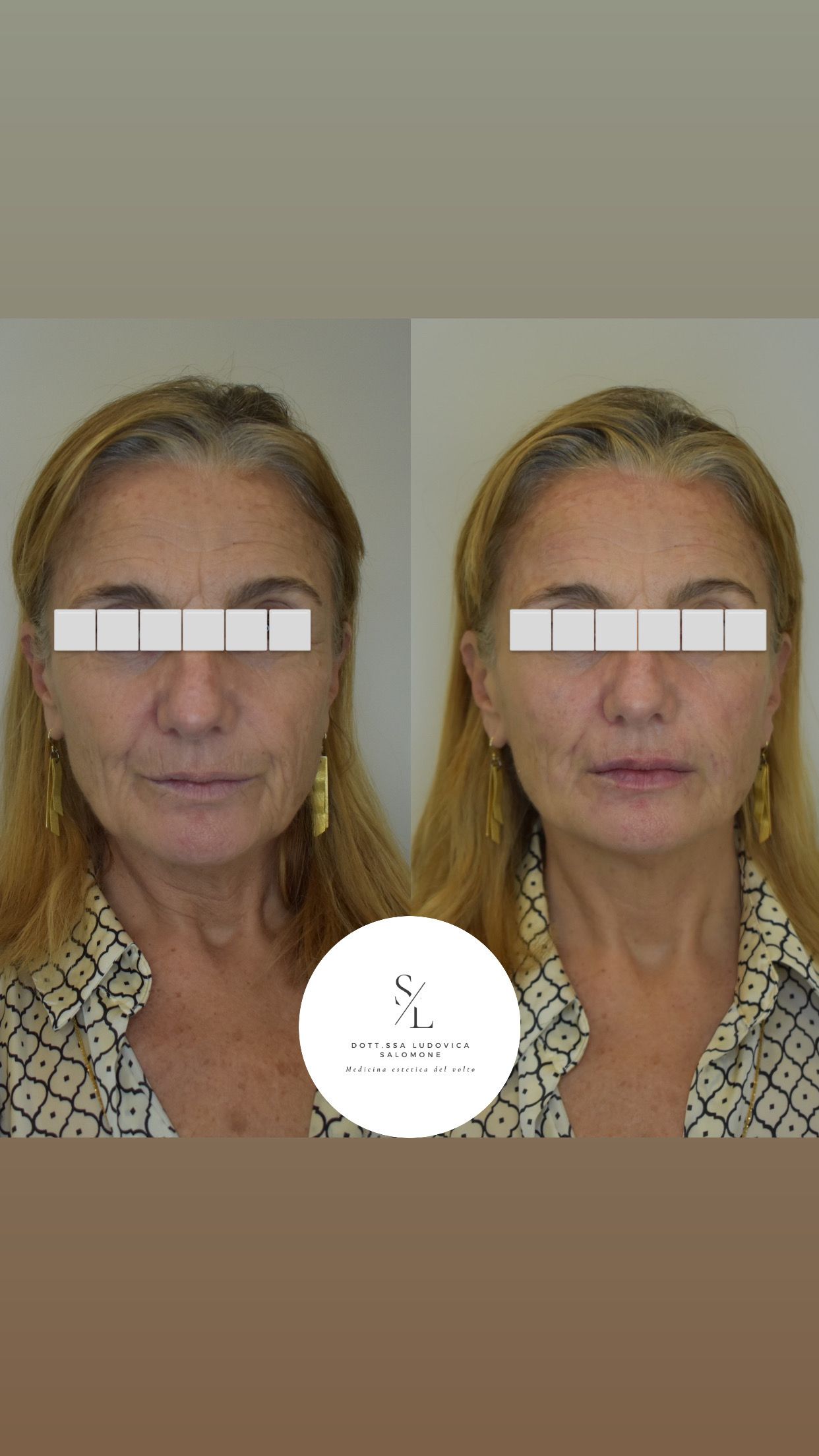 Ludovica Salomone-3
