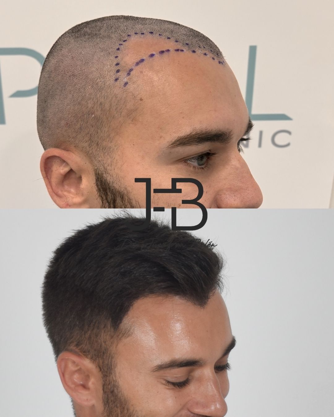 Juan Francisco Belén Montero-11