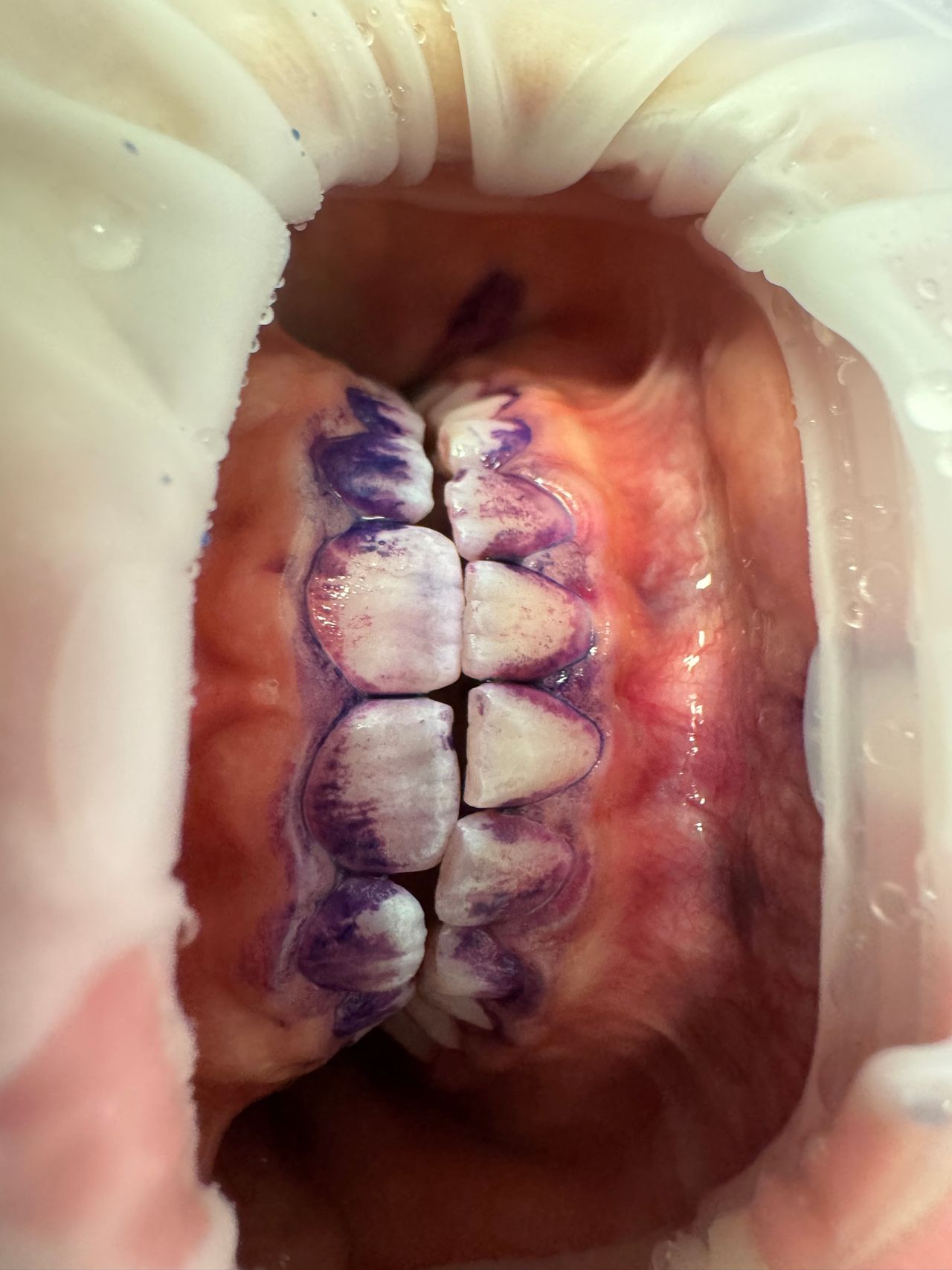 Anna Ziółkowska-11