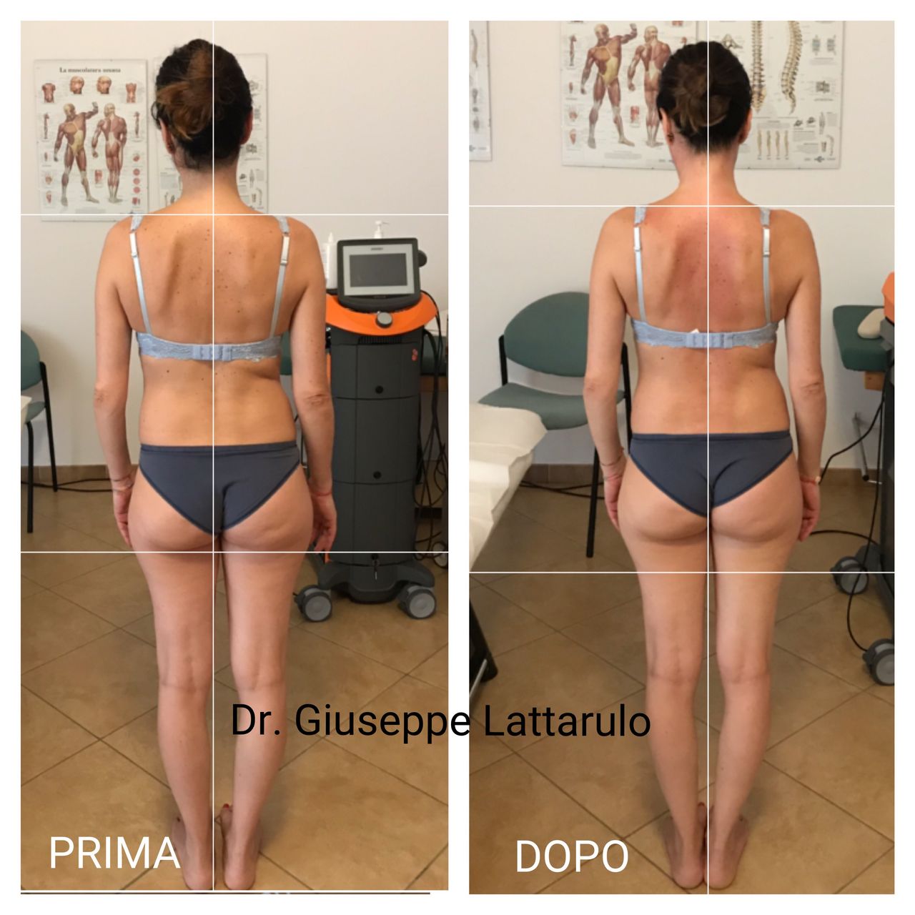 Giuseppe Lattarulo-9