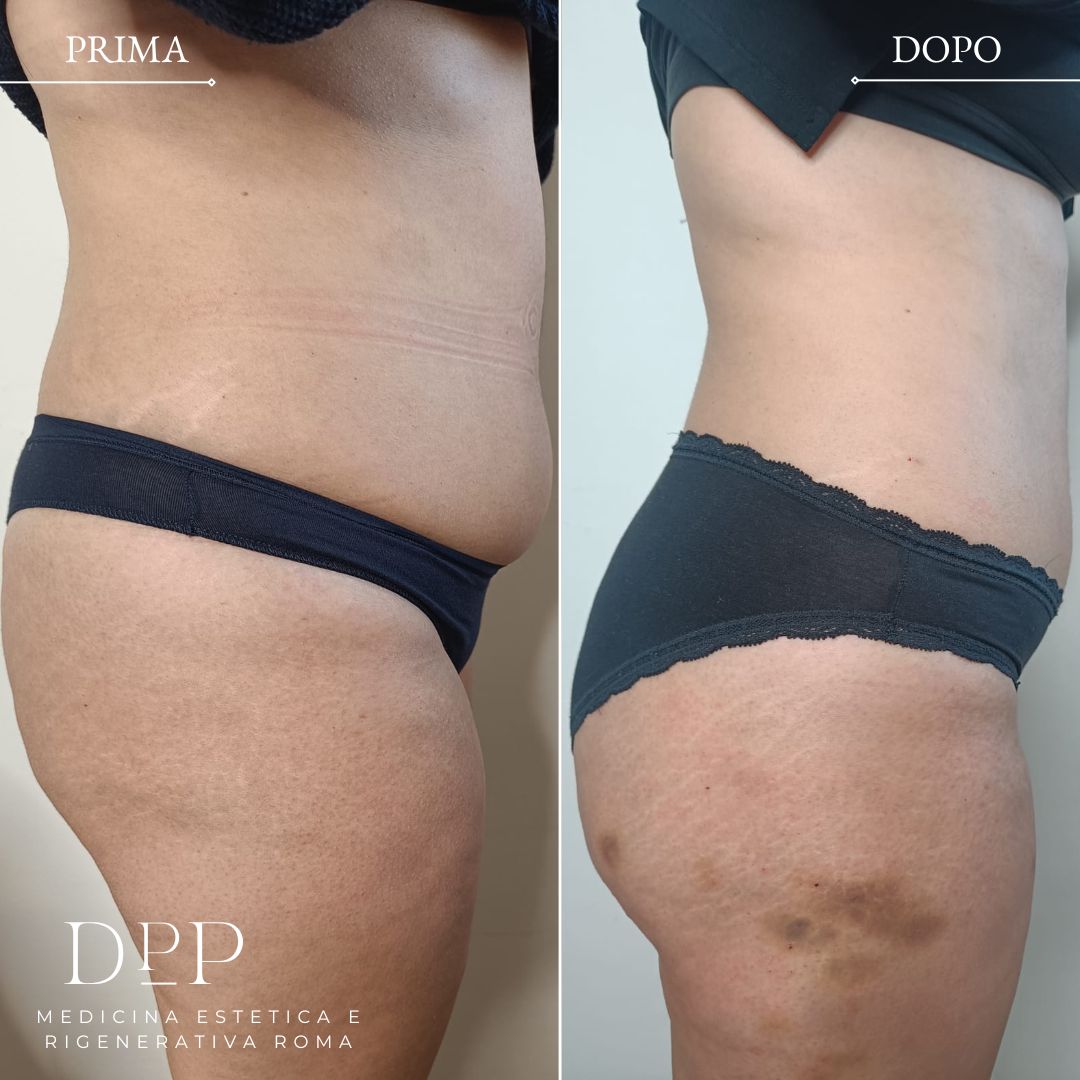 Davide Prosperi Porta-0