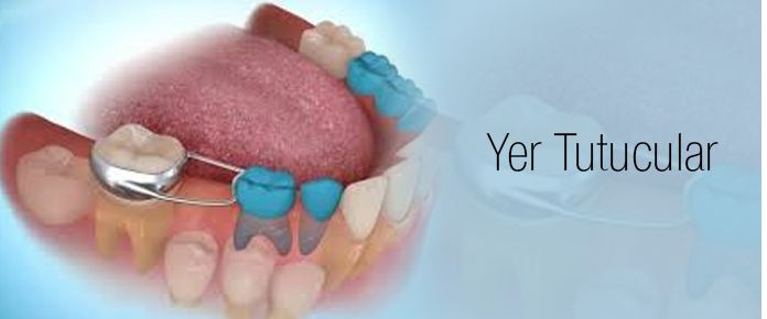 Neslihan Özyörük Yıldırım-7