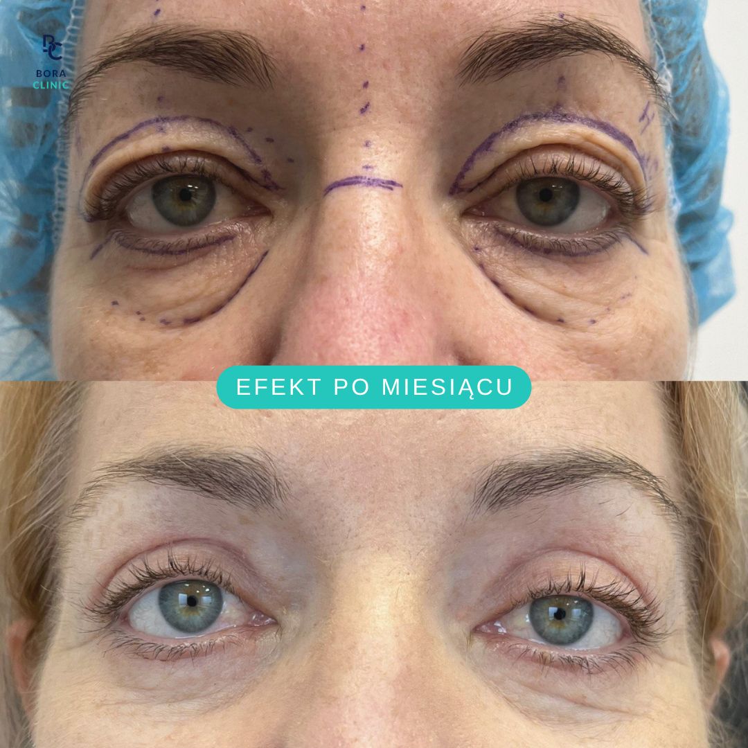 Anastasiia Grechyshkina-8