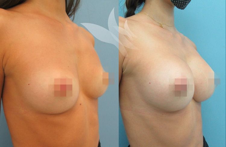 Irasema Regla Bezares Ramos-5