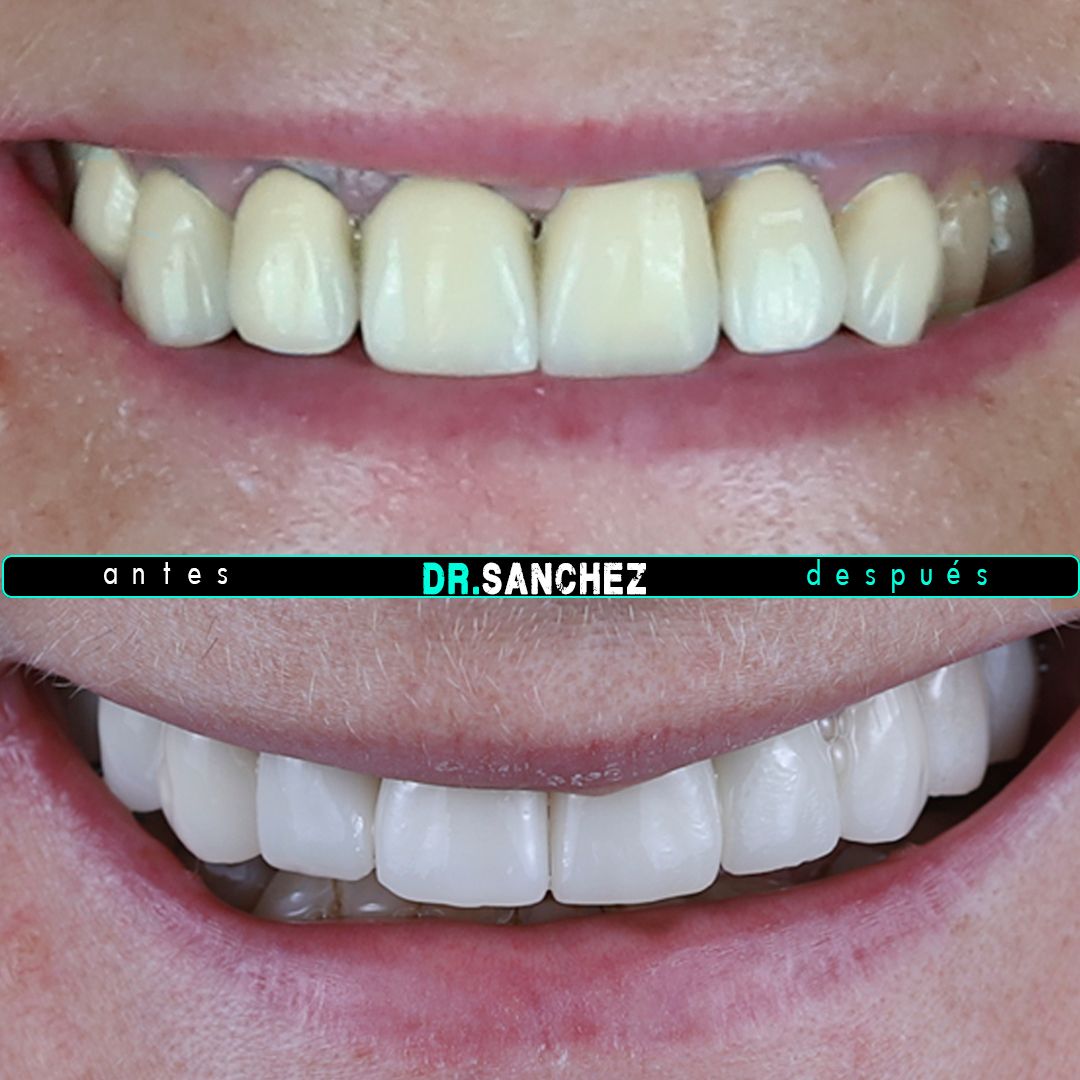 Juan Carlos Sánchez Pérez-3