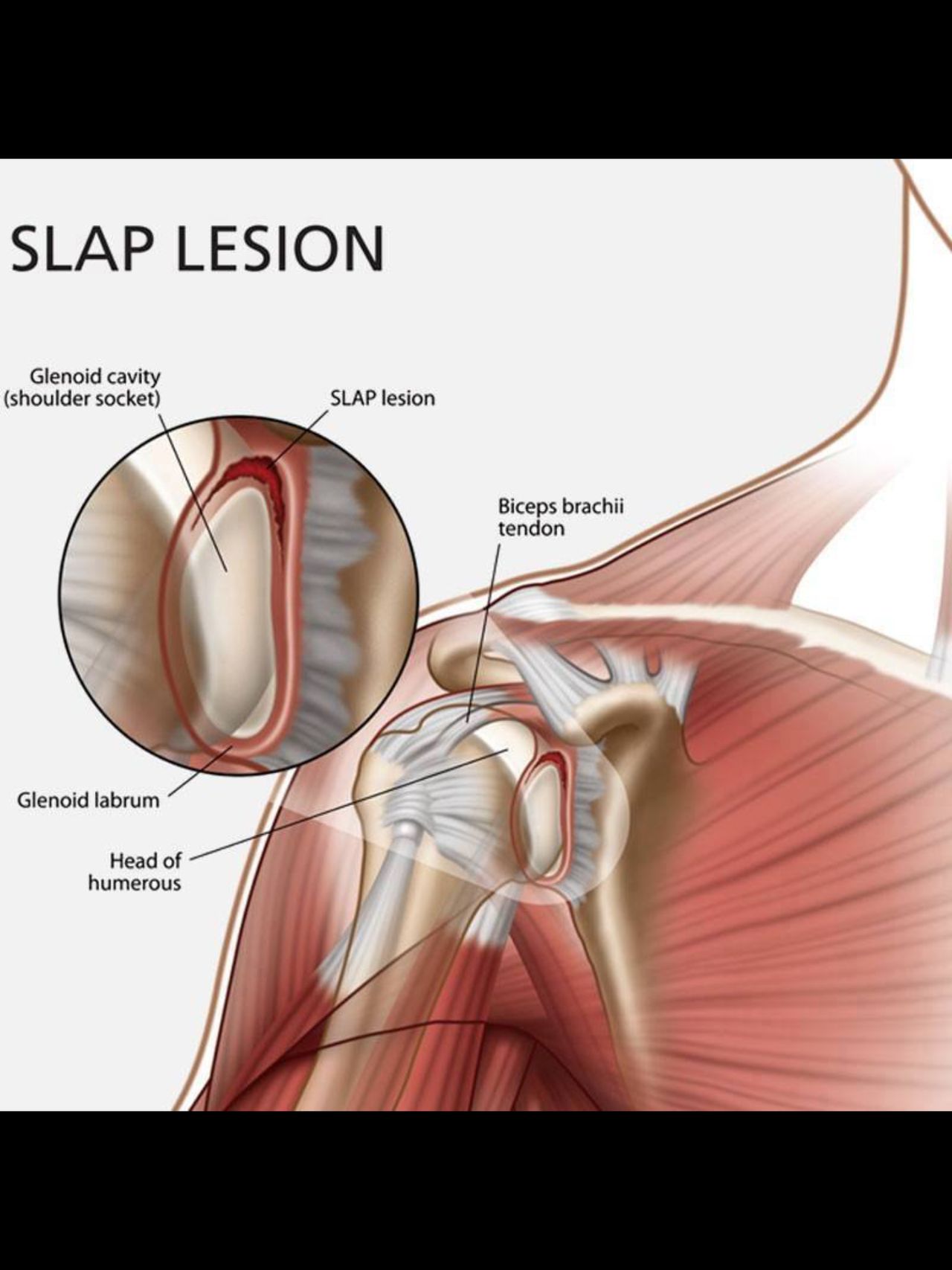 Giuseppe Lombardo-43