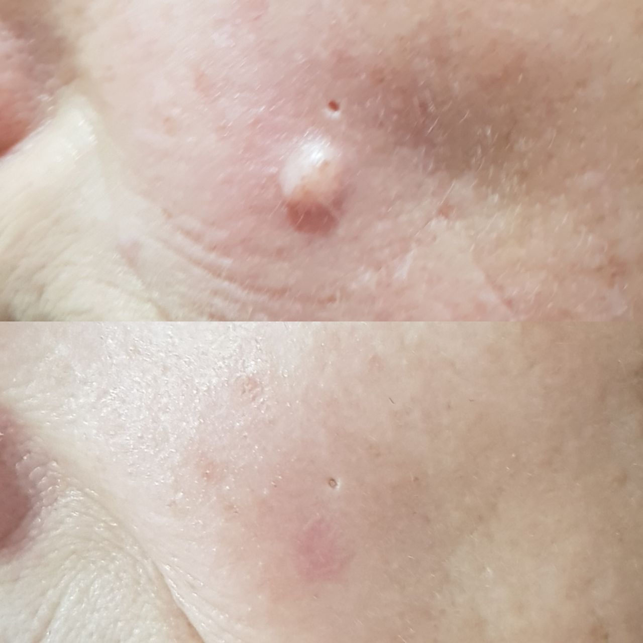 Rosalba Herrero Zerpa-500