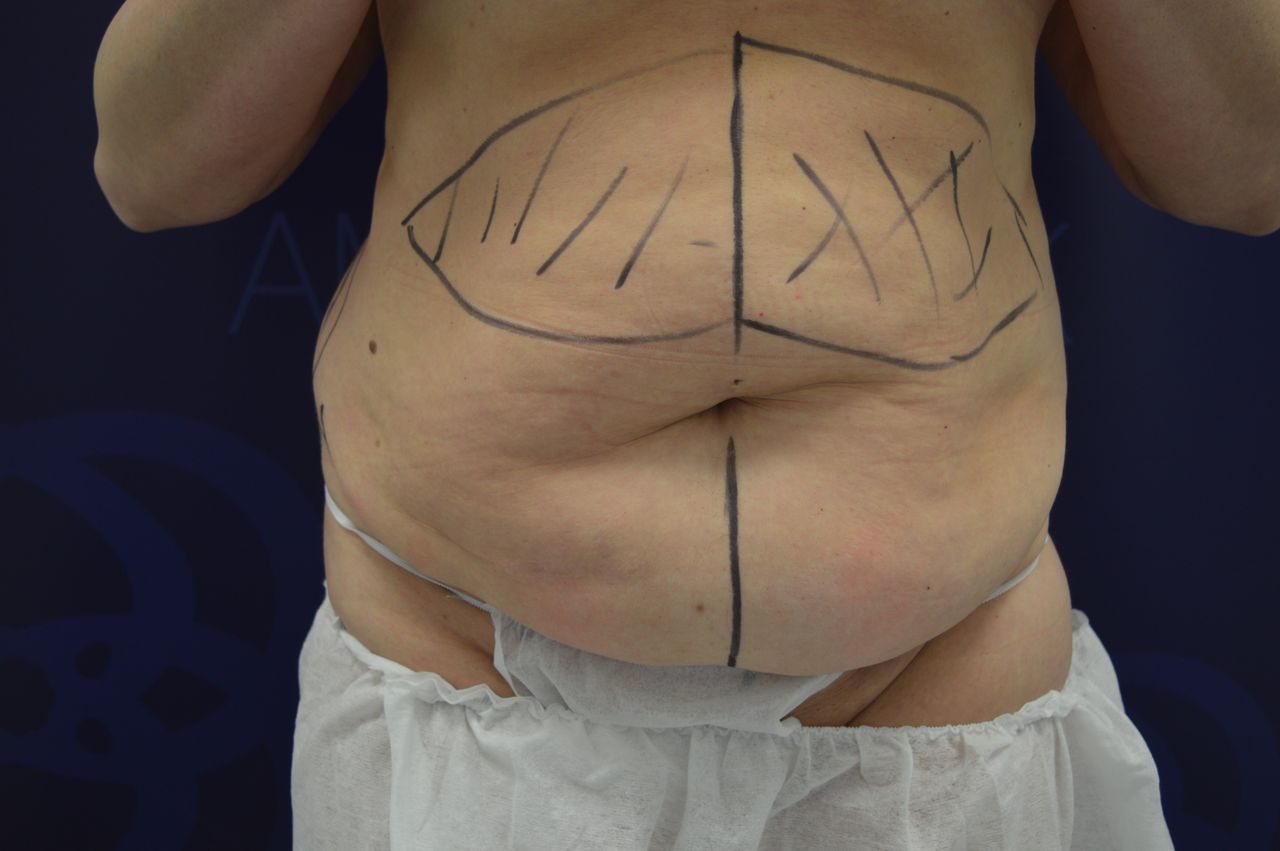 Christoffer Ingves-4