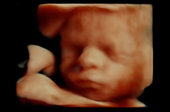 Tommaso Incandela-37