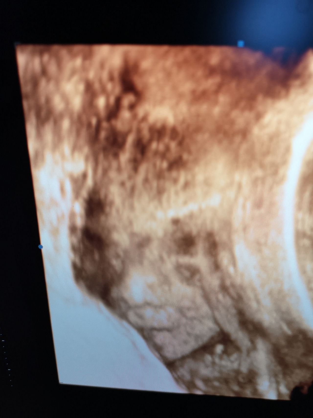 Francesco Paolo Improda-10