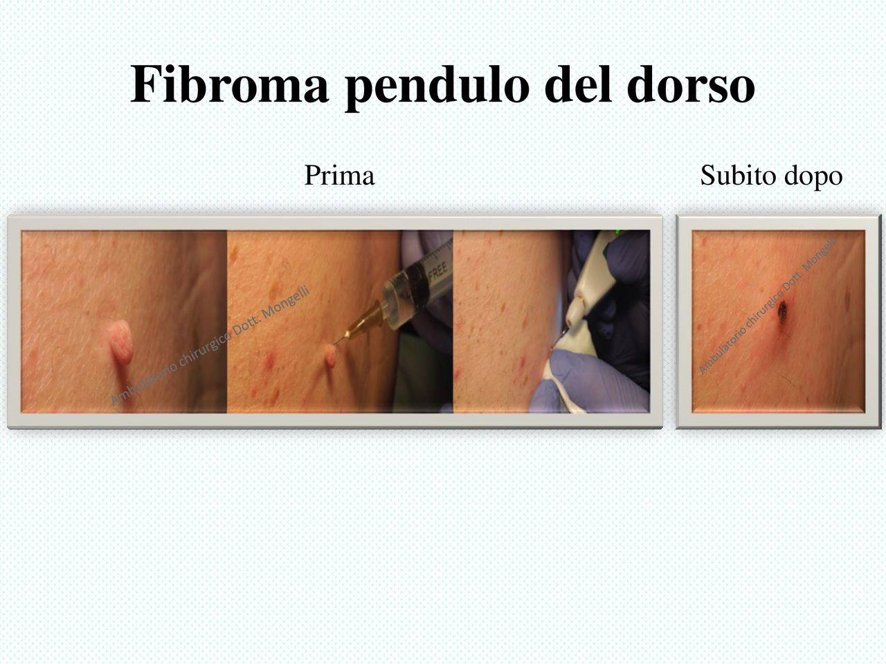 Matteo Antonio Mongelli-8