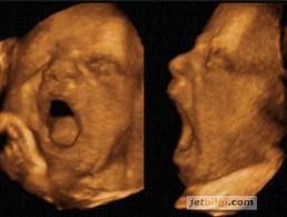 Alper Gümüşalan-4