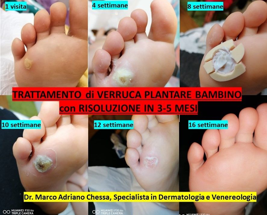 Marco Adriano Chessa-1