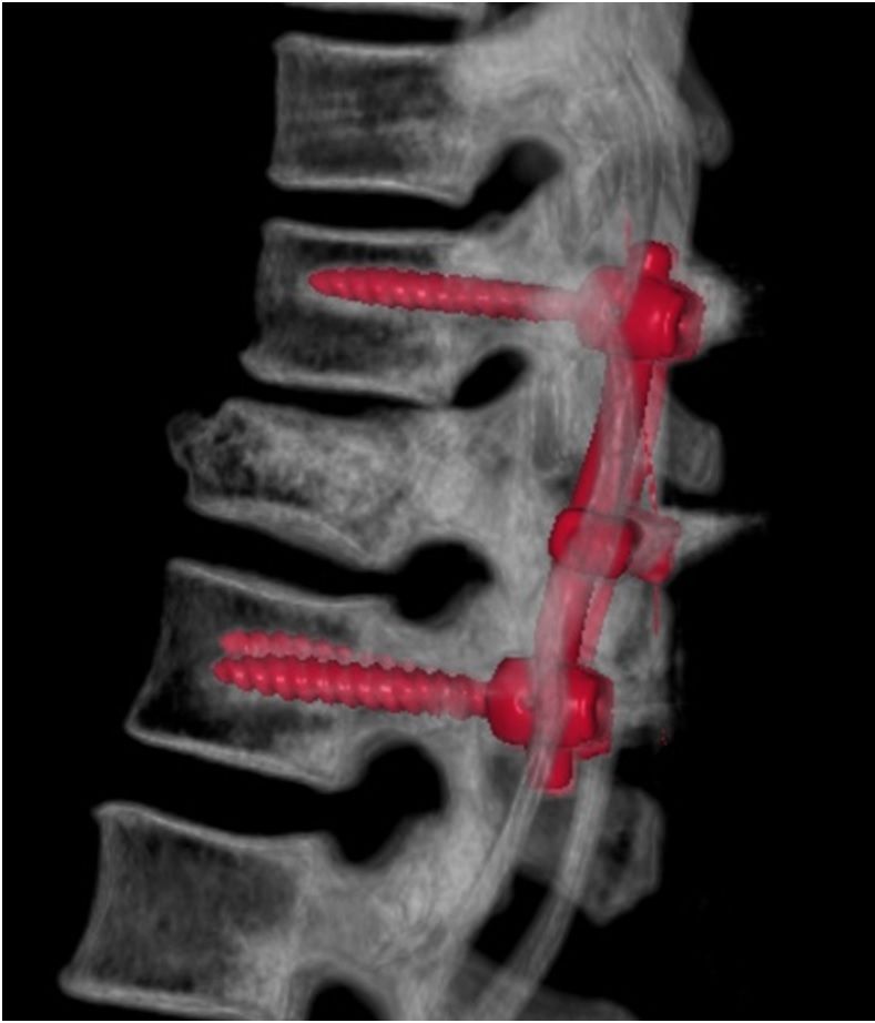 Alessandro Borderi-18