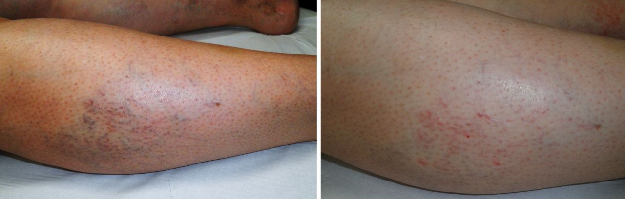 Edoardo Leonardo Rubattu-41