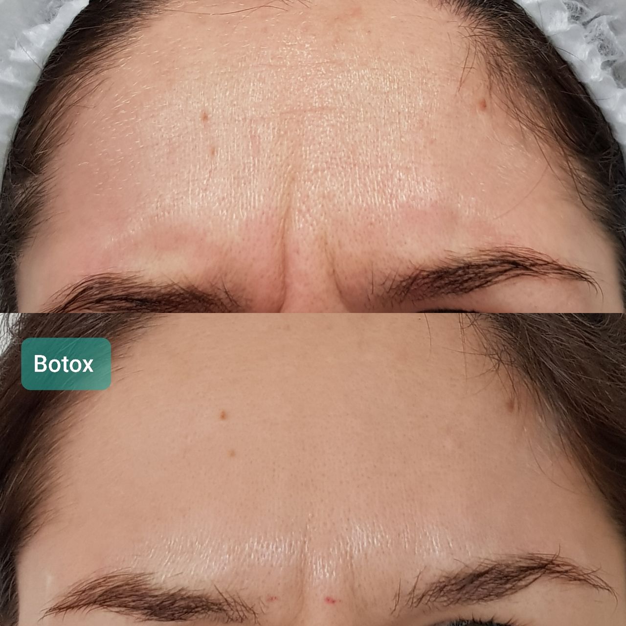 Rosalba Herrero Zerpa-349