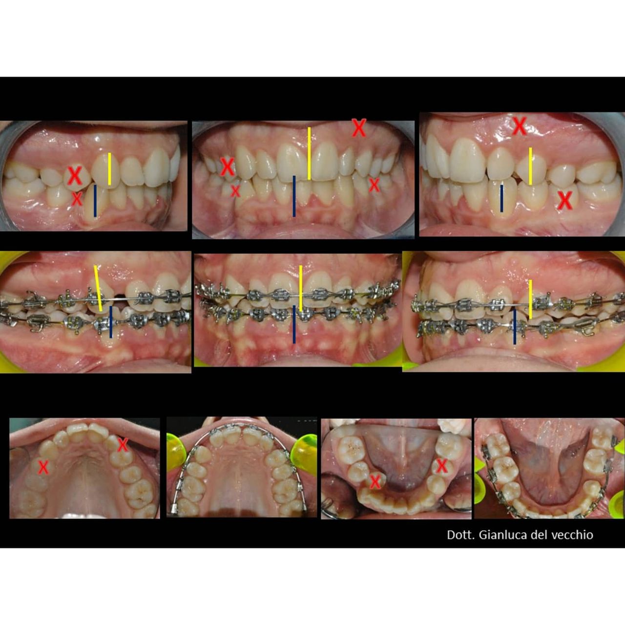 Gianluca Del Vecchio-82